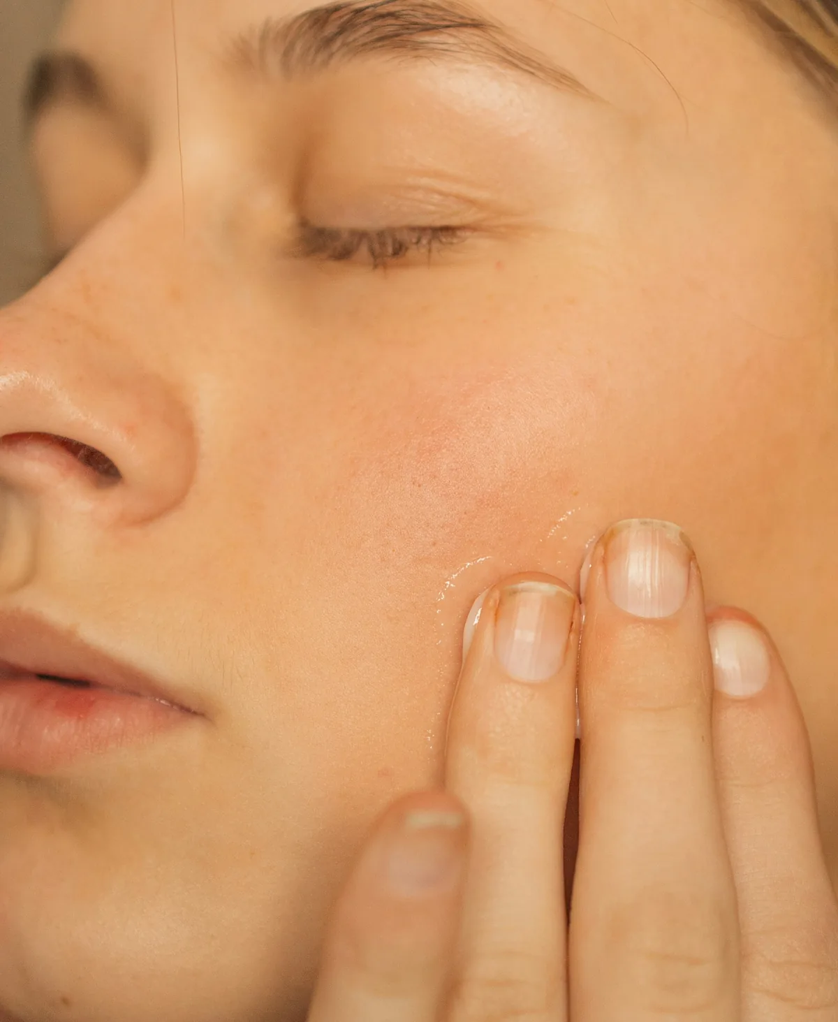Bright, even, refreshed skin — VI Peel at Levesque Plastic Surgery, Austin TX